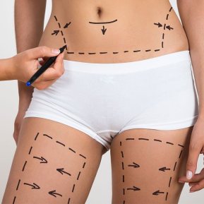 liposuccion abdominale Tunisie