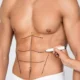 Prix Liposuccion Six Pack Tunisie