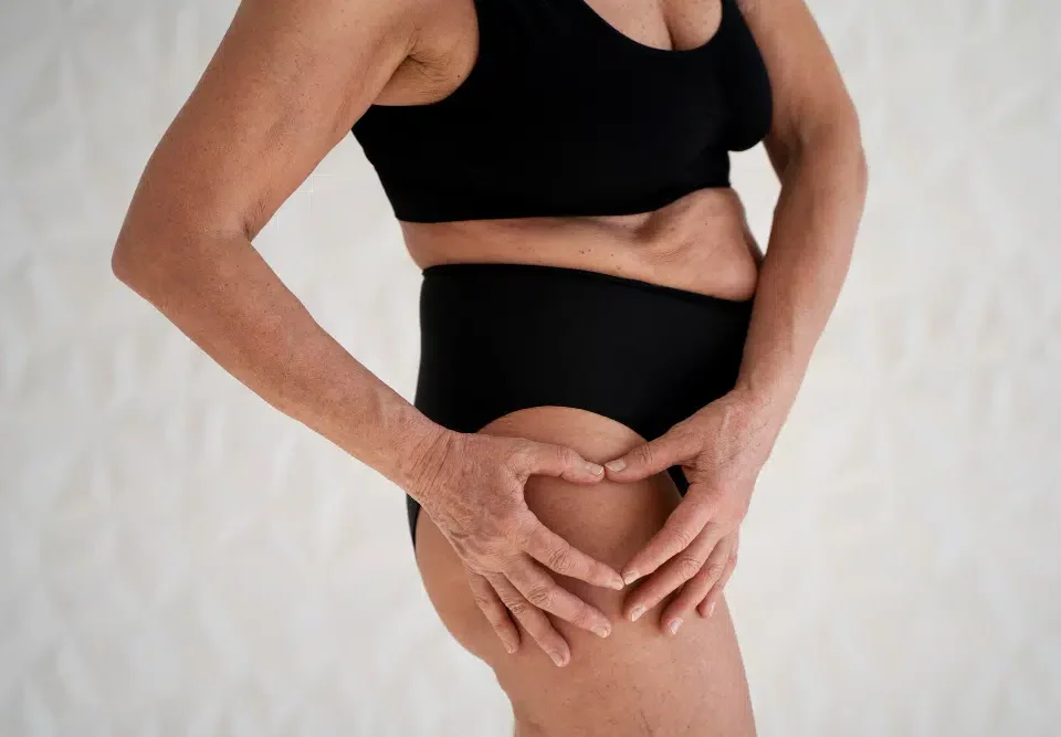 Combien de temps faut-il pour récupérer après une liposuccion des cuisses ?