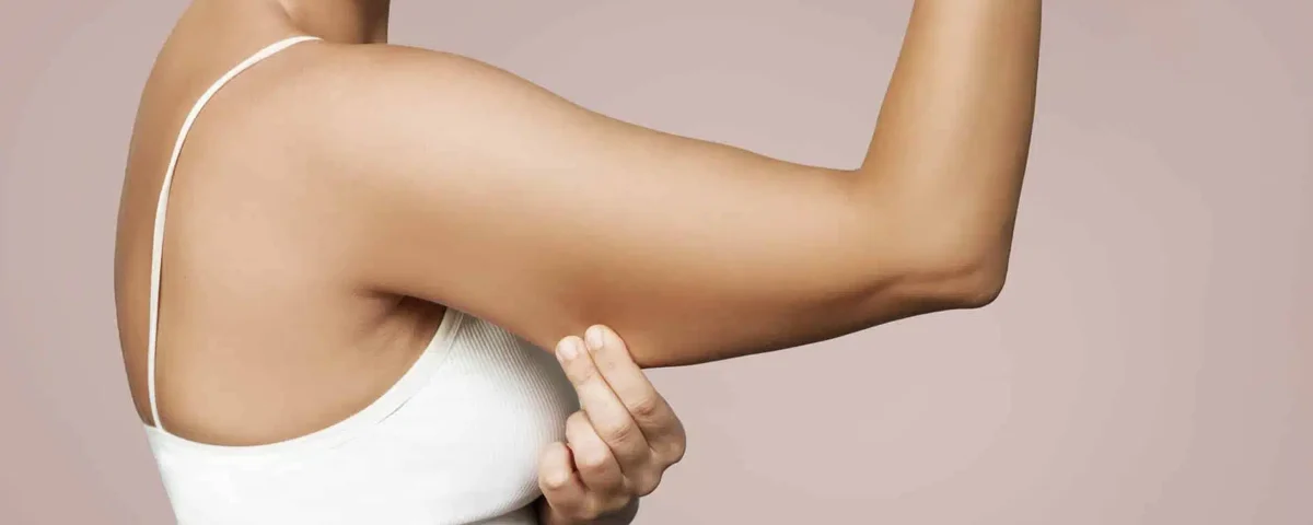 Combien de temps dure la convalescence après une liposuccion des bras ?