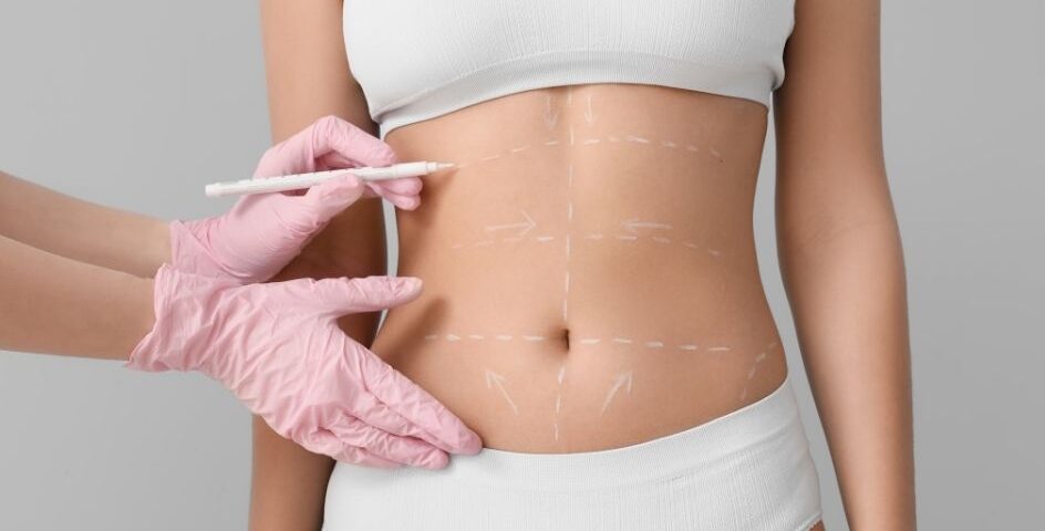 Quelle est la différence entre J Plasma et Vaser Lipo ?