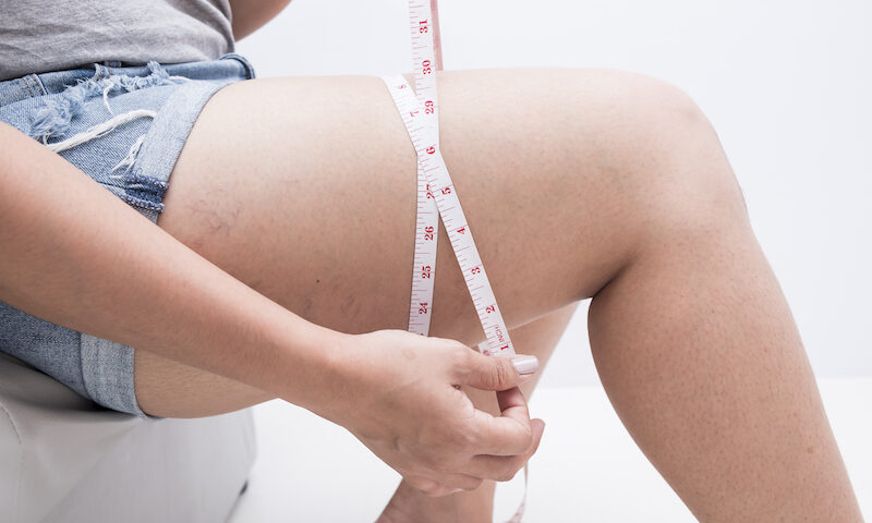 Comment une femme peut-elle perdre des cuisses rapidement ?