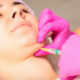 Est-il possible d'enlever un double menton avec une injection ?