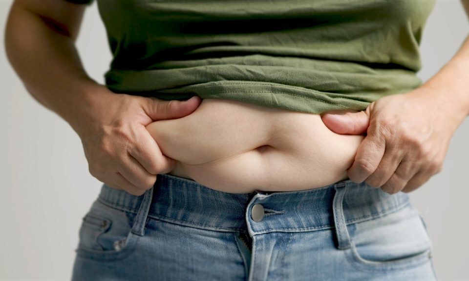La graisse se stocke-t-elle dans le ventre après une liposuccion ?