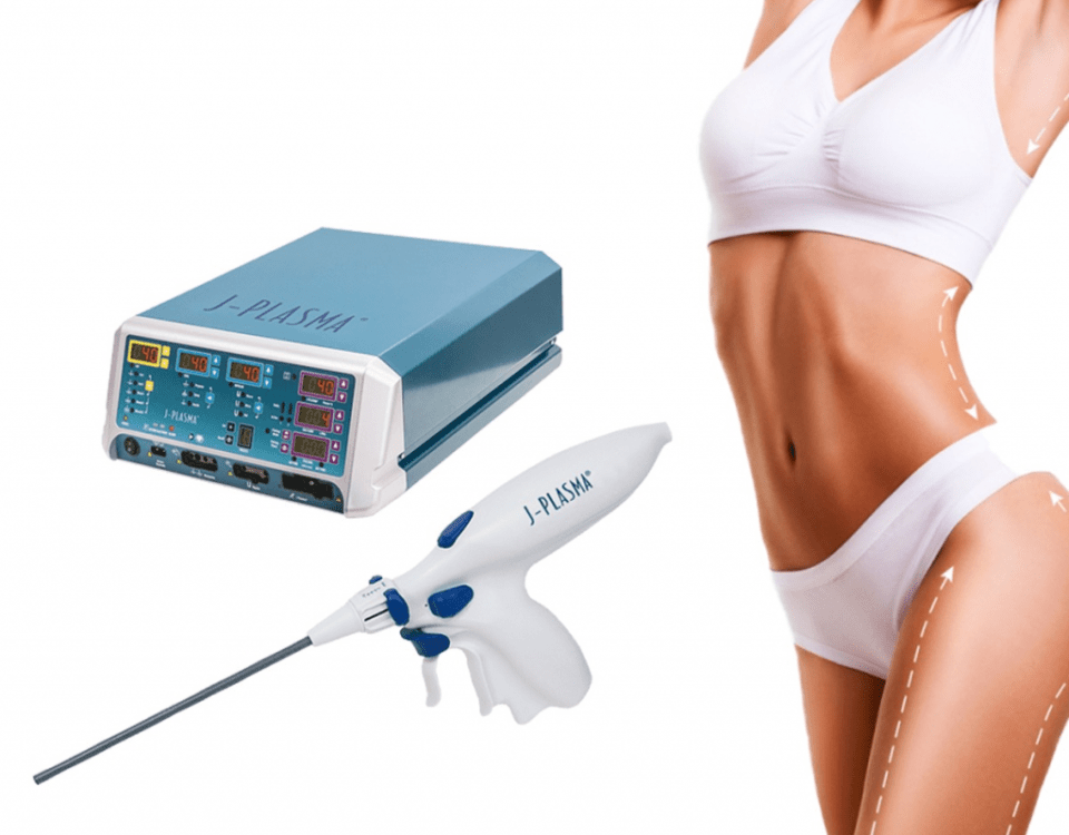 Raffermissement des bras et des cuisses après liposuccion avec Renuvion et J-Plasma
