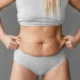 Lipœdème et relâchement abdominal