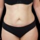 Liposuccion HD et sculpture abdominale