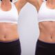 Liposuccion VASER 360°