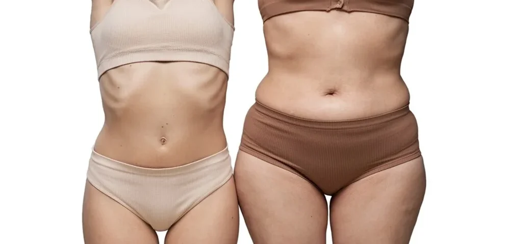 Liposuccion vs traitements non chirurgicaux des amas graisseux