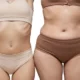 Liposuccion vs traitements non chirurgicaux des amas graisseux