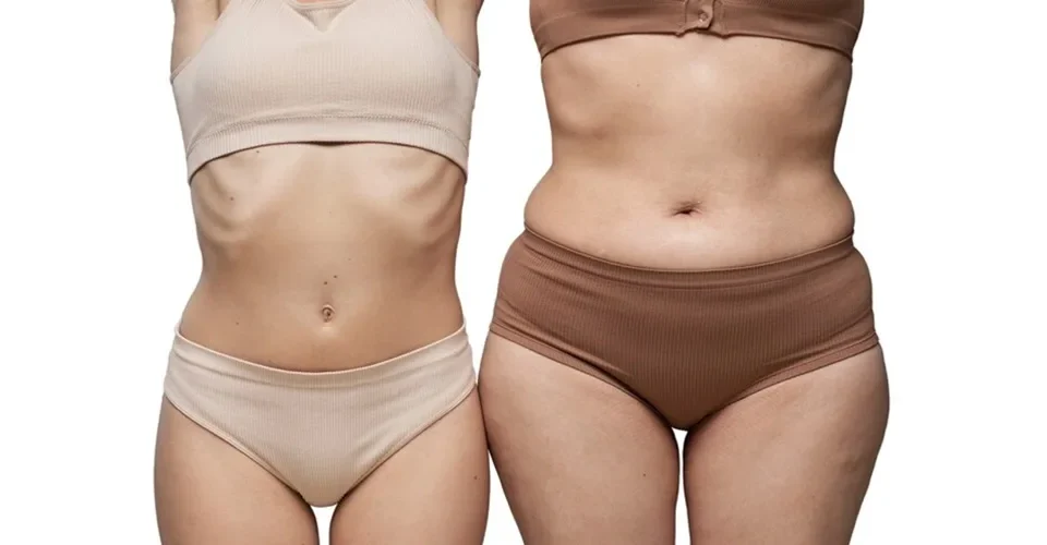 Liposuccion vs traitements non chirurgicaux des amas graisseux
