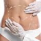 Traitement du lipœdème par liposuccion 360°