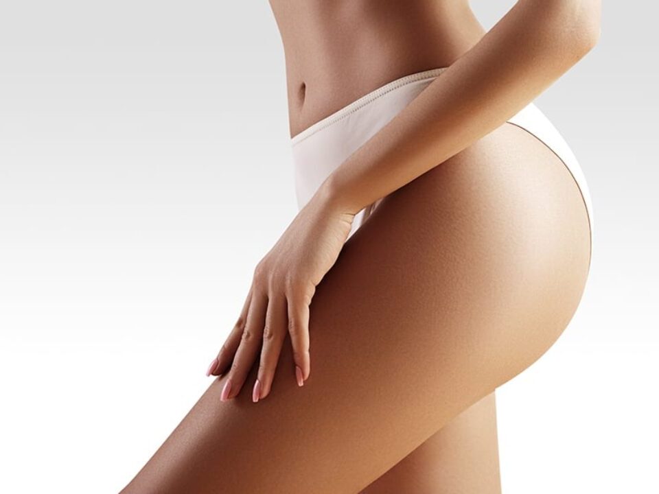 Liposuccion avec réinjection de graisse dans les hanches