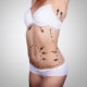Liposculpture HD et BodyTite RFAL en Tunisie